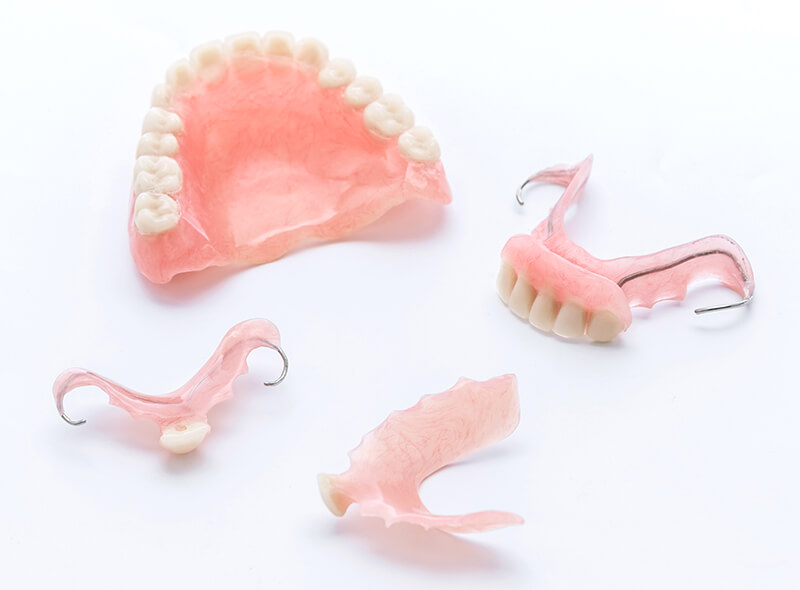 4つの異なる種類の義歯